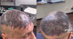 Hombre-se-tatua-la-cabeza-para-simular-que-tiene-cabello