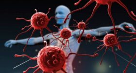 Nuevos-hallazgos-confirman-que-la-aterosclerosis-es-una-enfermedad-autoinmune-de-celulas-T