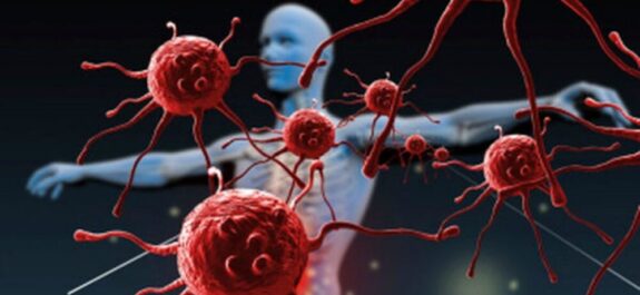 Nuevos-hallazgos-confirman-que-la-aterosclerosis-es-una-enfermedad-autoinmune-de-celulas-T