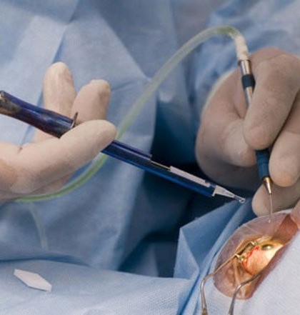 Se efectuará en SLP segunda jornada de cirugías de cataratas “para verte mejor”