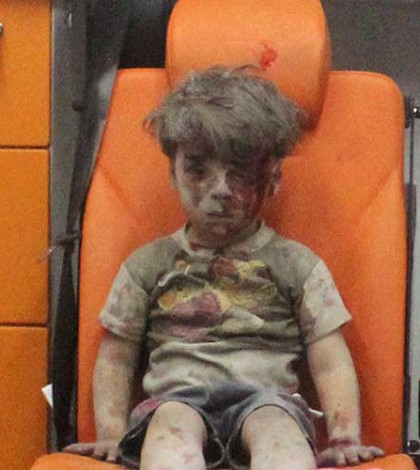 Más de 100 mil niños sirios sufren lo que Omran: Unicef