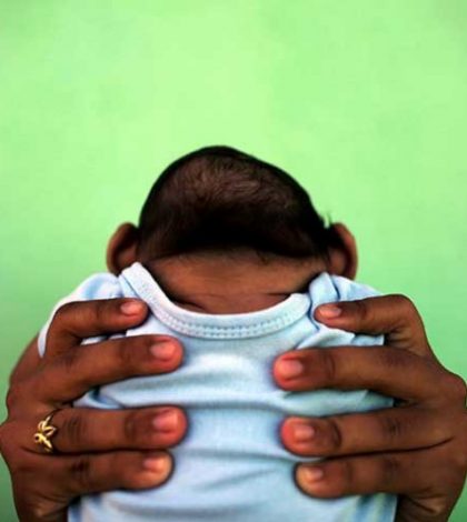 Virus de zika causa malformaciones en bebés
