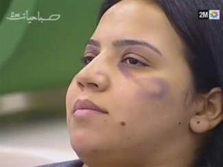 Enseña canal de TV a las mujeres a maquillarse para ocultar golpes