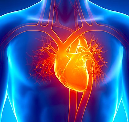 Enfermedades  cardiacas