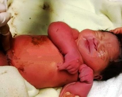 Rescatan a bebé recién nacido tirado a la basura en la Julián Carrillo