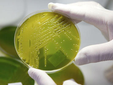 Bacteria del cólera puede provocar deshidratación letal