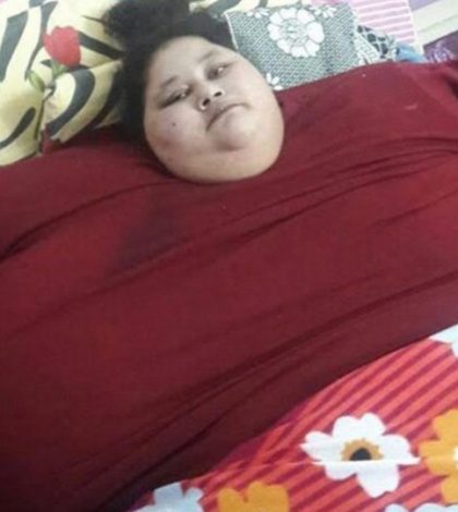Tratamiento de egipcia de 500 kilos termina en pelea con médicos