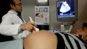 Detectan en el estado seis de casos zika en embarazadas