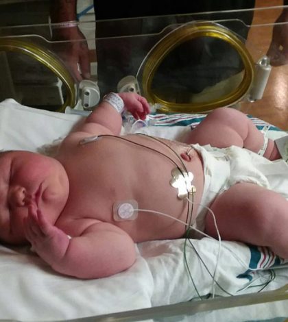 Mujer da a luz a una bebé de 6 kilos en Florida
