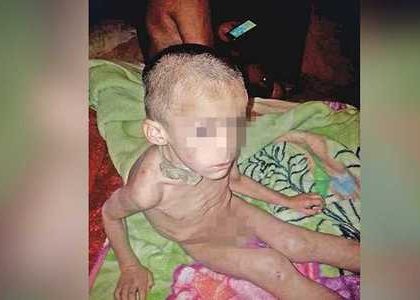 Un menor, la clave para el rescate de niño maltratado en GAM