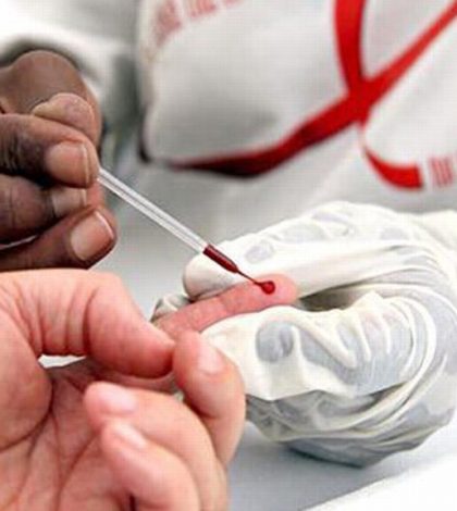 Más de 2 mil pacientes con VIH Sida en SLP