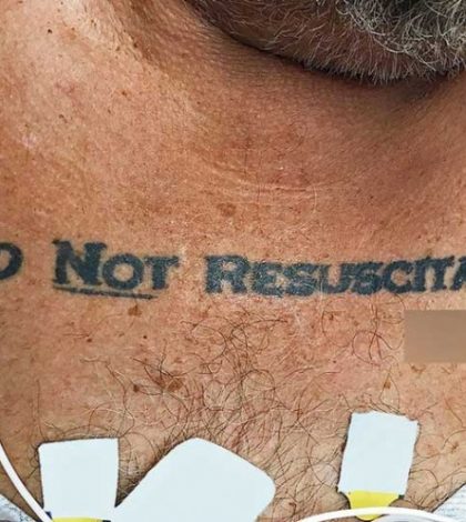 Este tatuaje conflictuó a varios médicos: ‘No resucitar’
