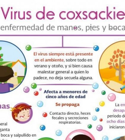 Úlceras en la boca y fiebre, síntomas del virus de Coxsackie: Ssa