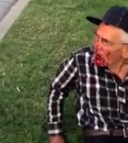 Golpean brutalmente a anciano mexicano en EU; ‘regresa a tu país’, le gritan