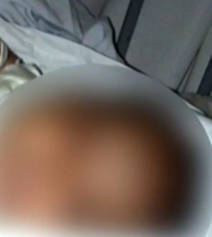 Bebé sufre quemaduras al estallar cohete de pirotecnia en Nuevo León