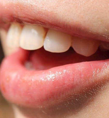 ¿Por qué se daña el esmalte dental? Científicos han descifrado el secreto