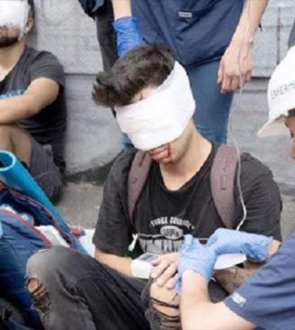 Fiscalía de Chile acusa a un policía de dejar ciego a un manifestante