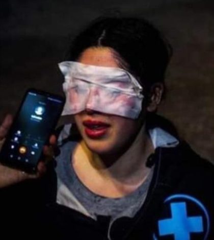 Profesora chilena sufre “ceguera temporal” por ataque de policías