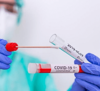 Se han realizado 70 mil pruebas de Covid en SLP durante la pandemia: SS