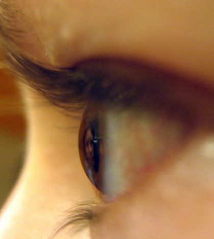 Paciente ciego recupera parcialmente la vista gracias a terapia innovadora