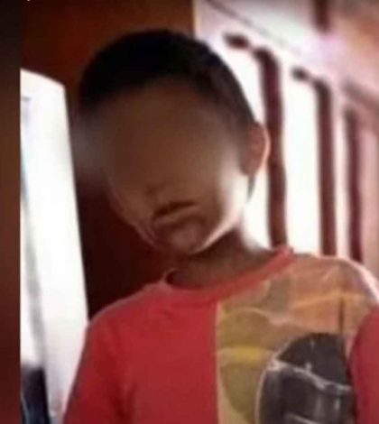 #Video: Patrulla atropella a niño en Edomex; piden ayuda para gastos médicos