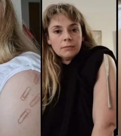 Mujer asegura que brazo vacunado contra covid-19 quedó como imán